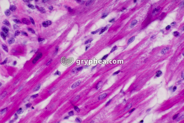 Fibres musculaires cardiaques CL x200 - gryphea.com